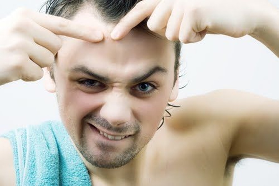 Nguy cơ gây mụn từ sáp vuốt tóc không rõ nguồn gốc.